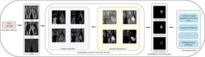 Segmentation model of soft tissue sarcoma based on self-supervised learning